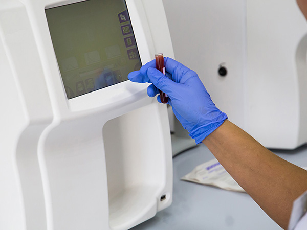 Blood gas analyzer